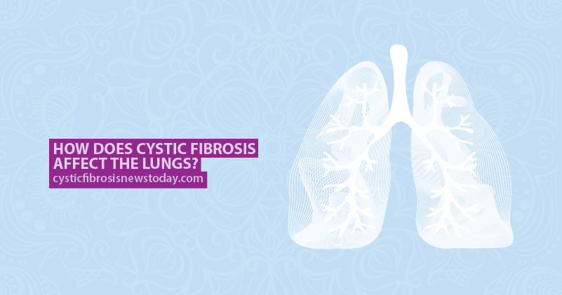 How Does Cystic Fibrosis Affect the Lungs? - Cystic How Does Cystic Fibrosis Affect the Lungs? - Cystic